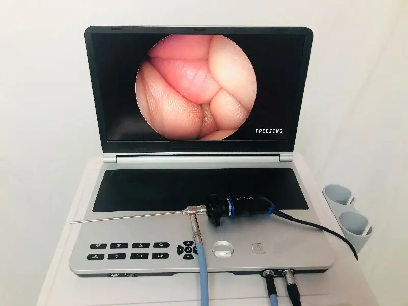 SmartFvet HV-D03 Ветеринарное оборудование Эндоскопическая система Электронная