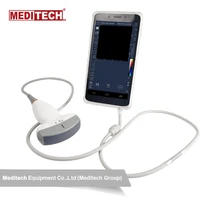 smart ultrasound android portable ultrasound