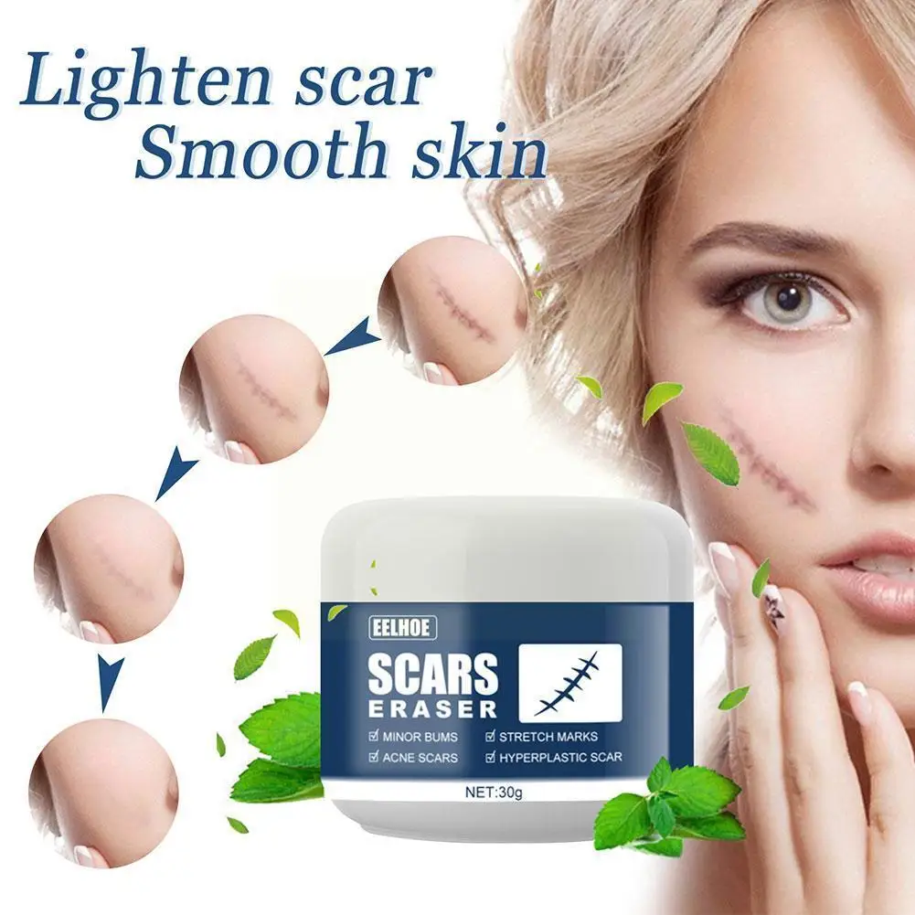 

30g Scar Removal Cream Acne Scars Stretch Marks Surgical Care Remove Smoothing Burn Gel Skin Body Scar W6p4