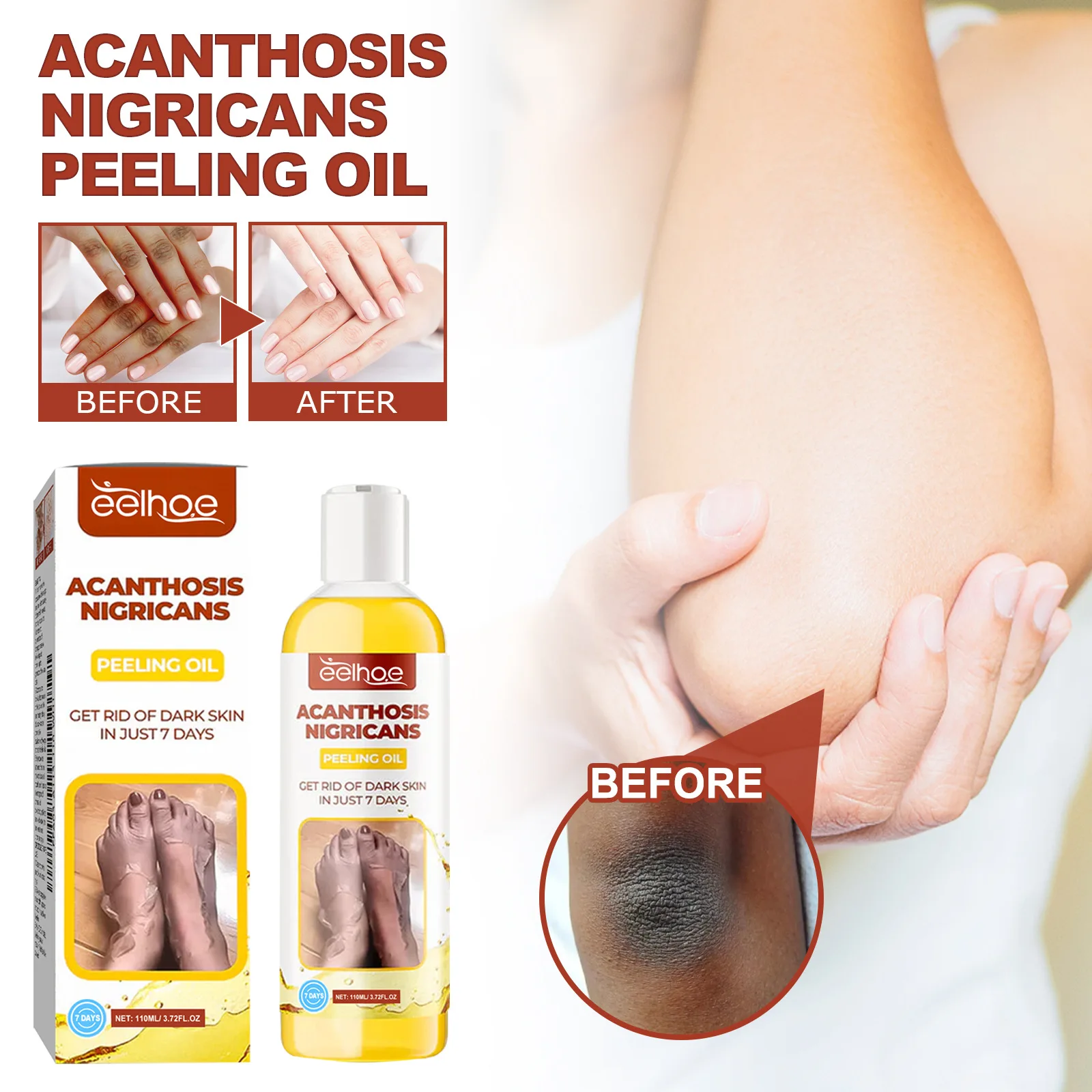 Отшелушивающее масло для кожи от черных тонов подмышек отбеливание и осветление