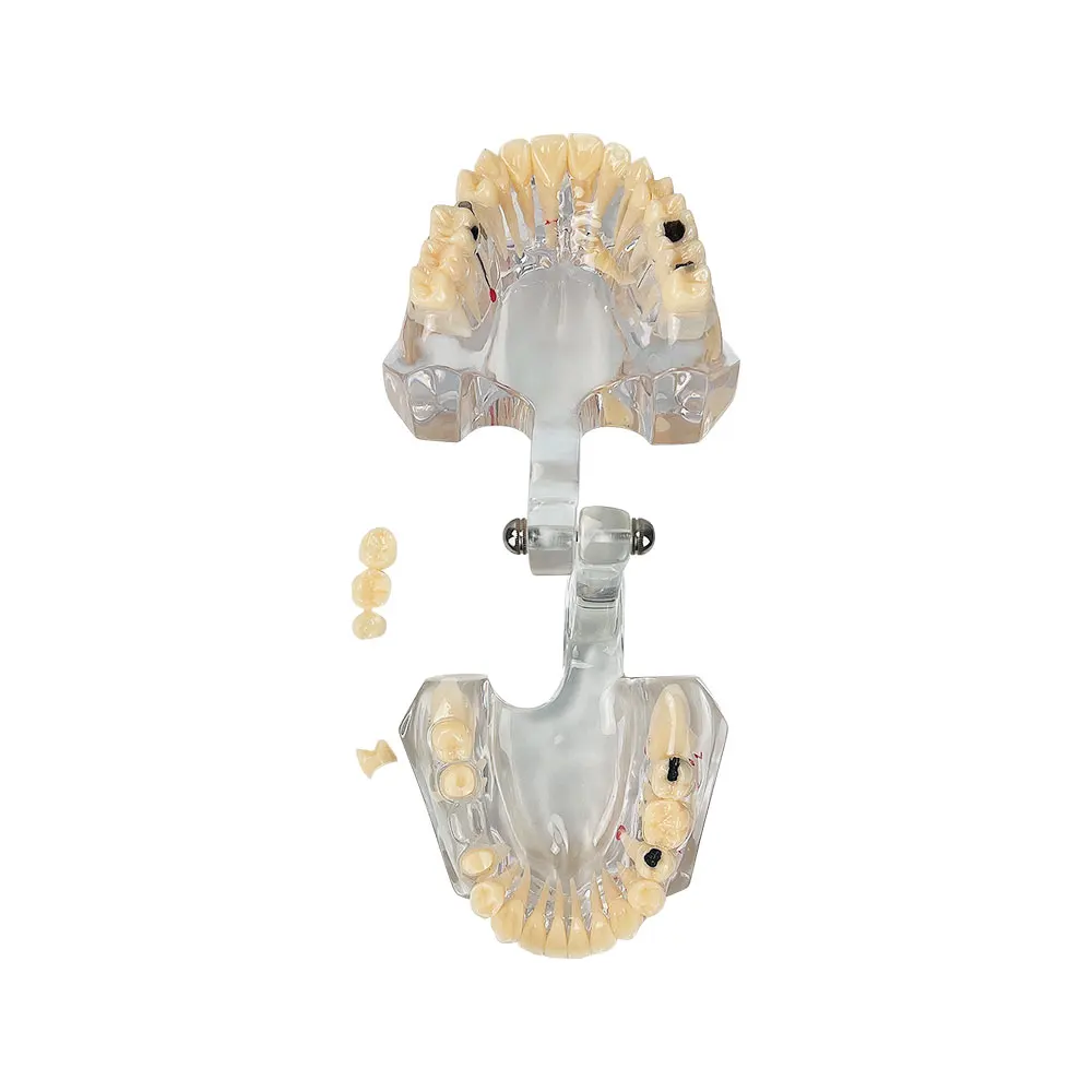 Модель зубов для стоматологической патологии 2 5 раза стоматология обучающая