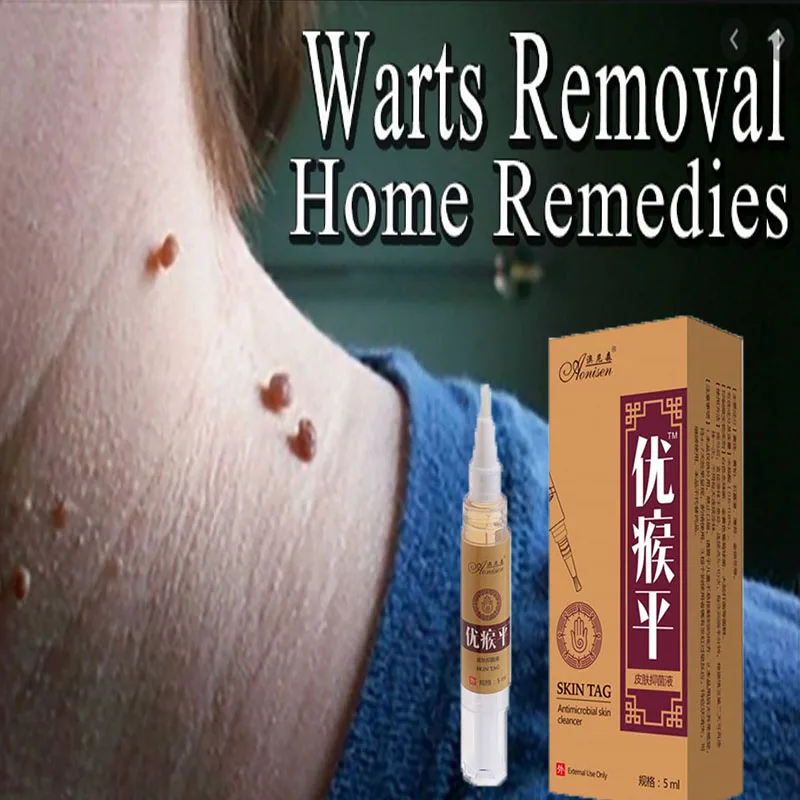 

5ML Skin Tag Remover Against Mole & Genital Wart fast RemovWithin al Anti Foot Corn Warts Papillomas Rapidly removes moles