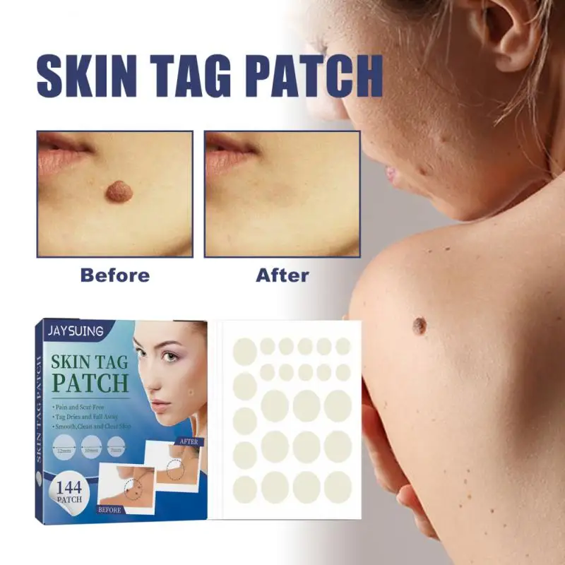 

144 шт., пластыри для удаления черных точек на лице