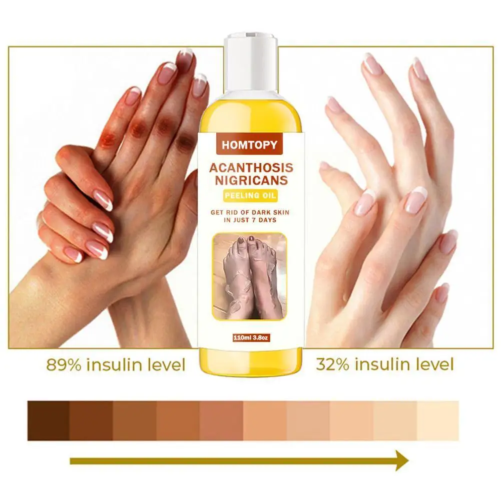 

110ml Yellow Peeling Oil Bleaching Dark Skin Lighten Serum Hands Tone Whitening Elbows Even Body Knees Care Effective Q8O1