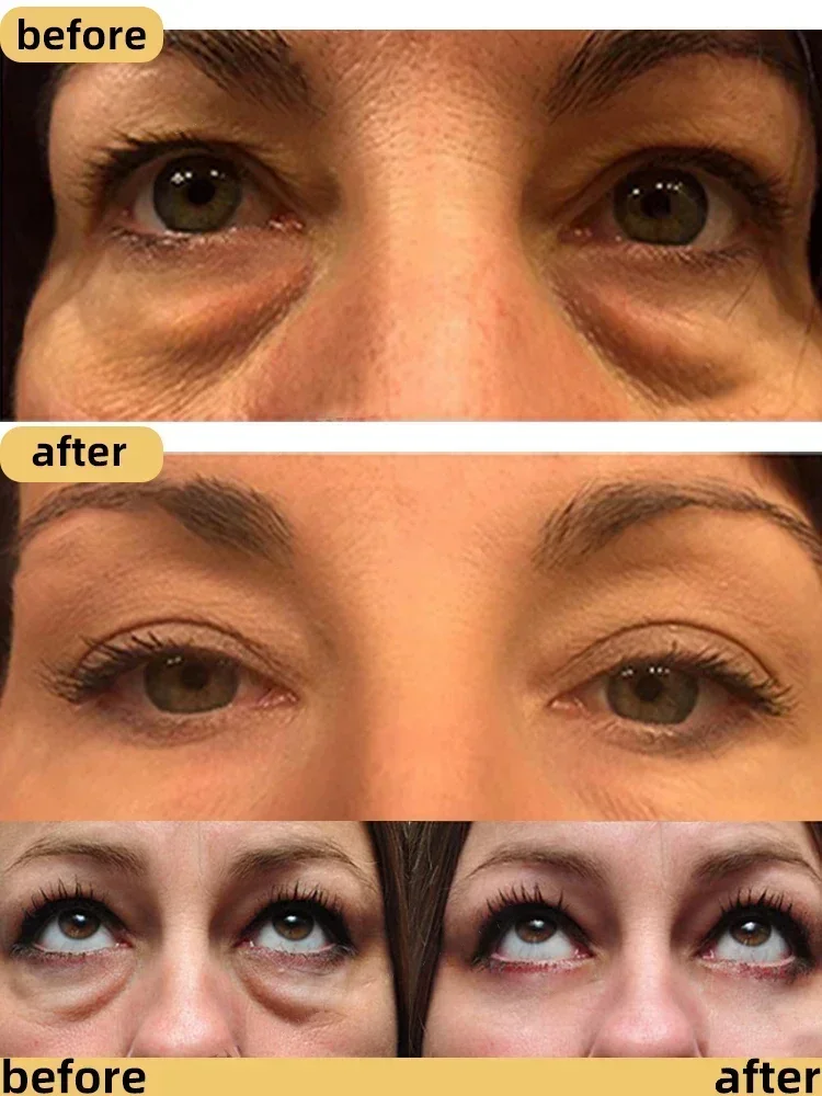 Сыворотка для области вокруг глаз от Тёмных кругов и мешков под глазами