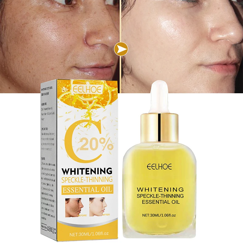 Facial Dark Spot Remover Whitening Essence Skin Lightening Melanin Chloasma Melasma Sunspots Removal Beauty Bleaching Serum 30ML