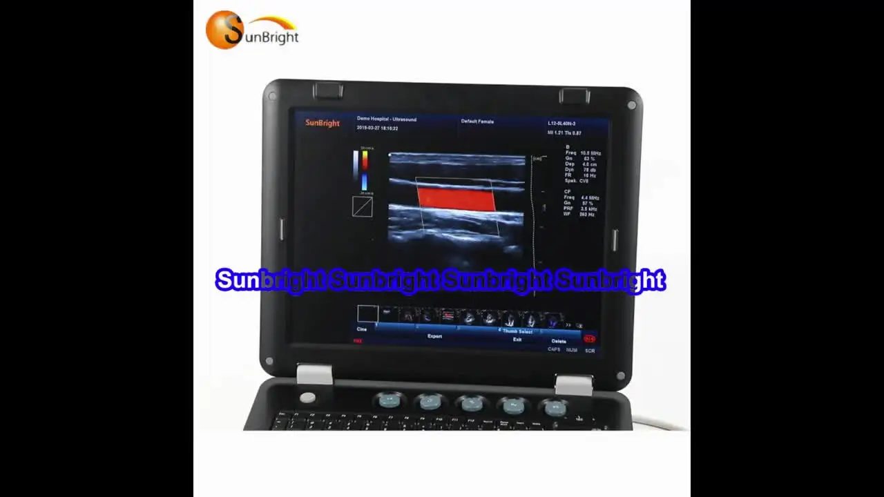 

Best manufacturer of 3d color doppler ultrasound SUN-906A