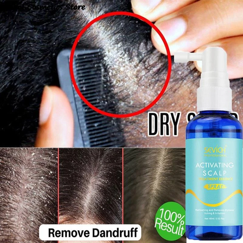 

Refreshing Scalp Cleansing Spray Anti-Dandruff Exfoliating Gently Nourish Soothing Massage Moisturizing Hair Care Products 60ml