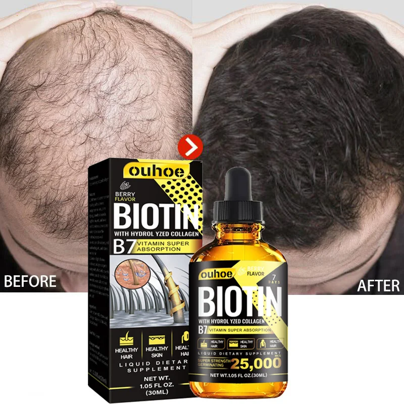 

Biotin Hair Growth Serum Anti Hair Loss Essential Oil Fast Growing Hair Care Products Health Scalp Treatments For Men Women 30ml