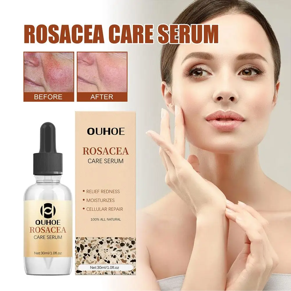 

30ml Rosacea Cure Serum Erythema Repair Essence Soothing Skin Serum And Repair Skin The Facial Care Moisturizing W9C6