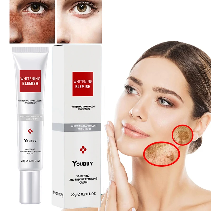 

Effective Whitening Freckle Face Cream Removal Melasma Acne Dark Spots Fade Pigment Melanin Moisturizing Brighten Skin Care 20g