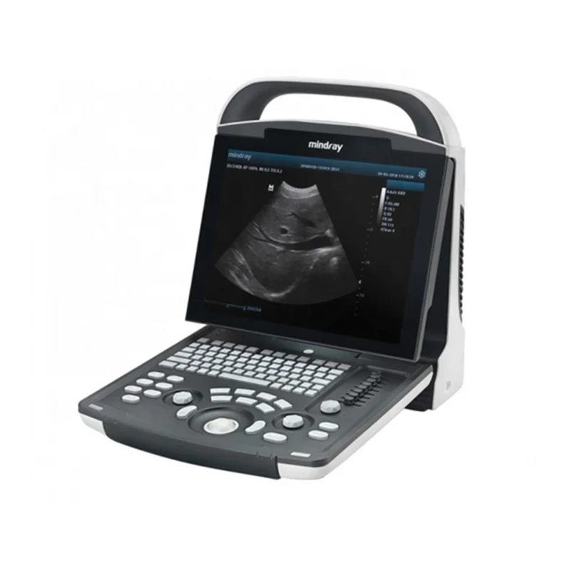 

Mindray DP-20 Portable Ultrasound Price Ultrasound Machine Medical Ultrasound Instruments For Sale