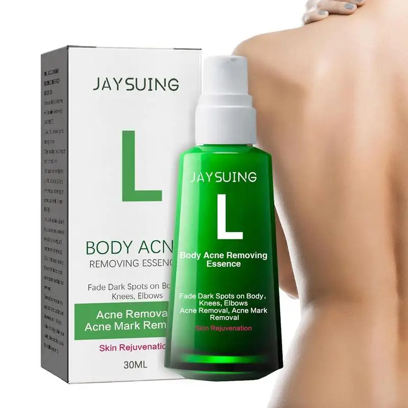 

Pimple Spot Serums Body Pimples Repair Serums 30ml Acnes Removing Essence Face Essence Body Skin Fade Dark Spots On Body