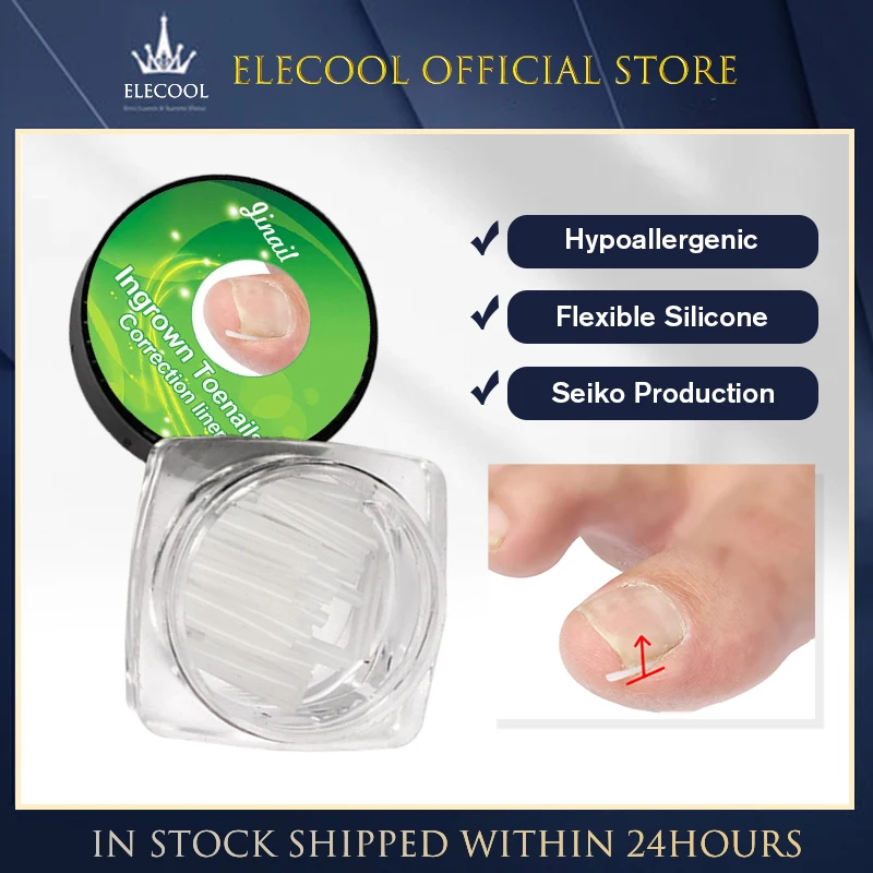 1-10 шт. инструмент для коррекции вросших ногтей