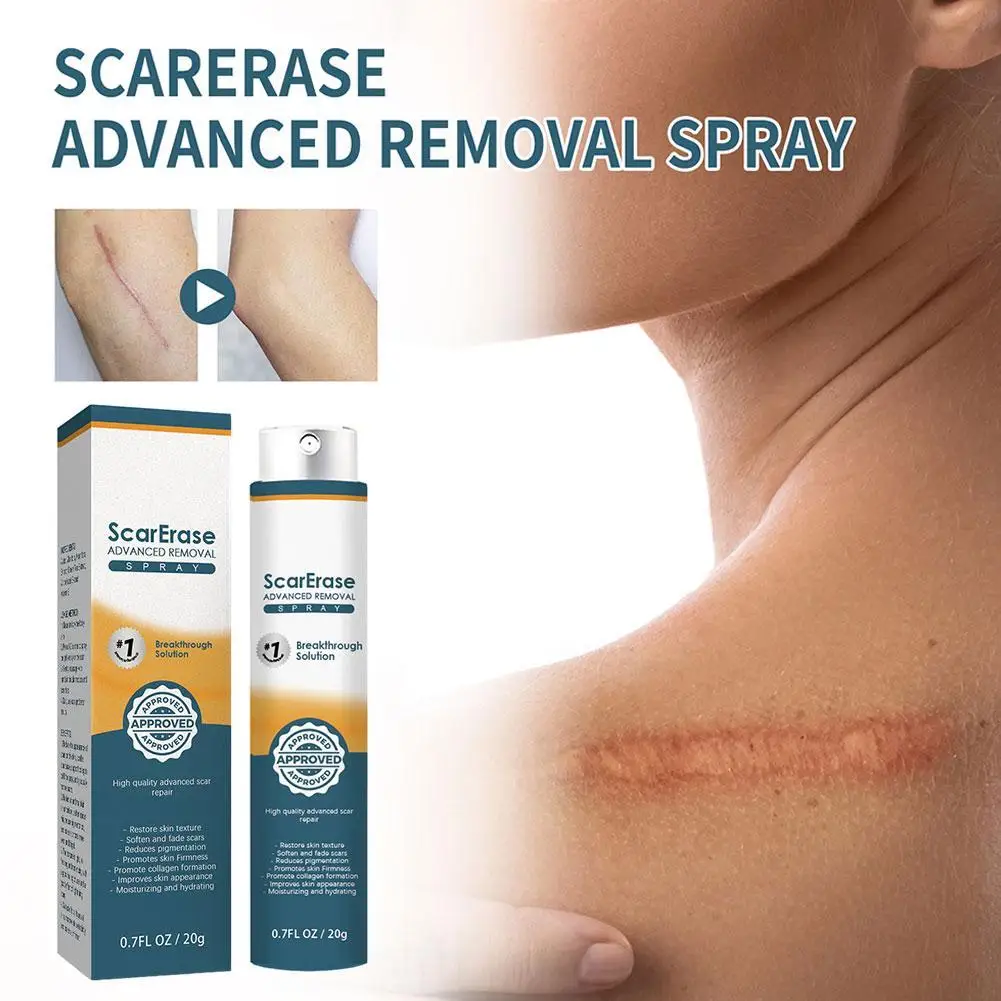 

Scar Removal Spray Treatment Burn Surgical Stretch Marks Remove Acne Spots Repair Gel Smooth Whitening Firming Skin Care Product