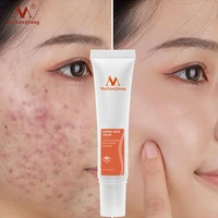 acne removal cream herbal effective acne treatment spots oil control moisturizing whitening cream skin care products cosmetics
