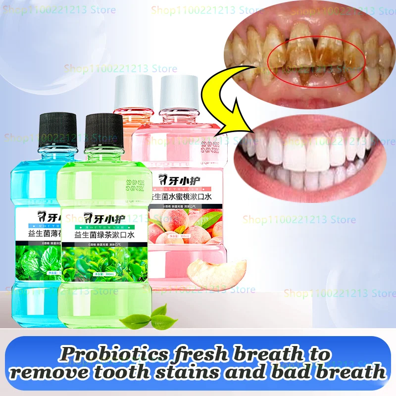 

Probiotics Fresh Breath To Remove Tooth Stains In Addition To Bad Breath Men and Girls Portable Mouthwash