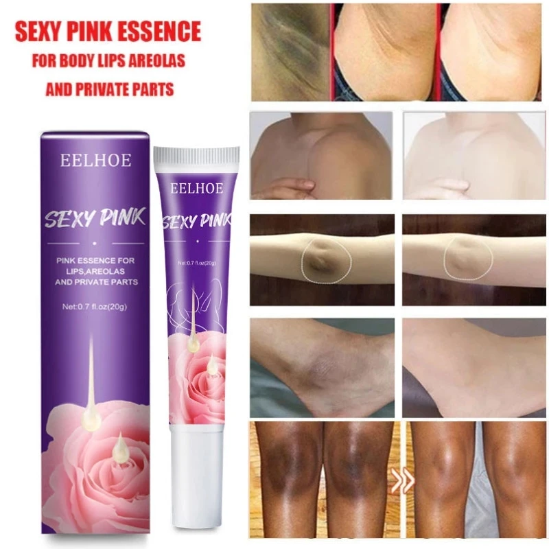 

Крем для отбеливания тела, интимная область, розовая эссенция, подмышки, колени, ягодиц, увеличивает яркость губ, средство для красоты