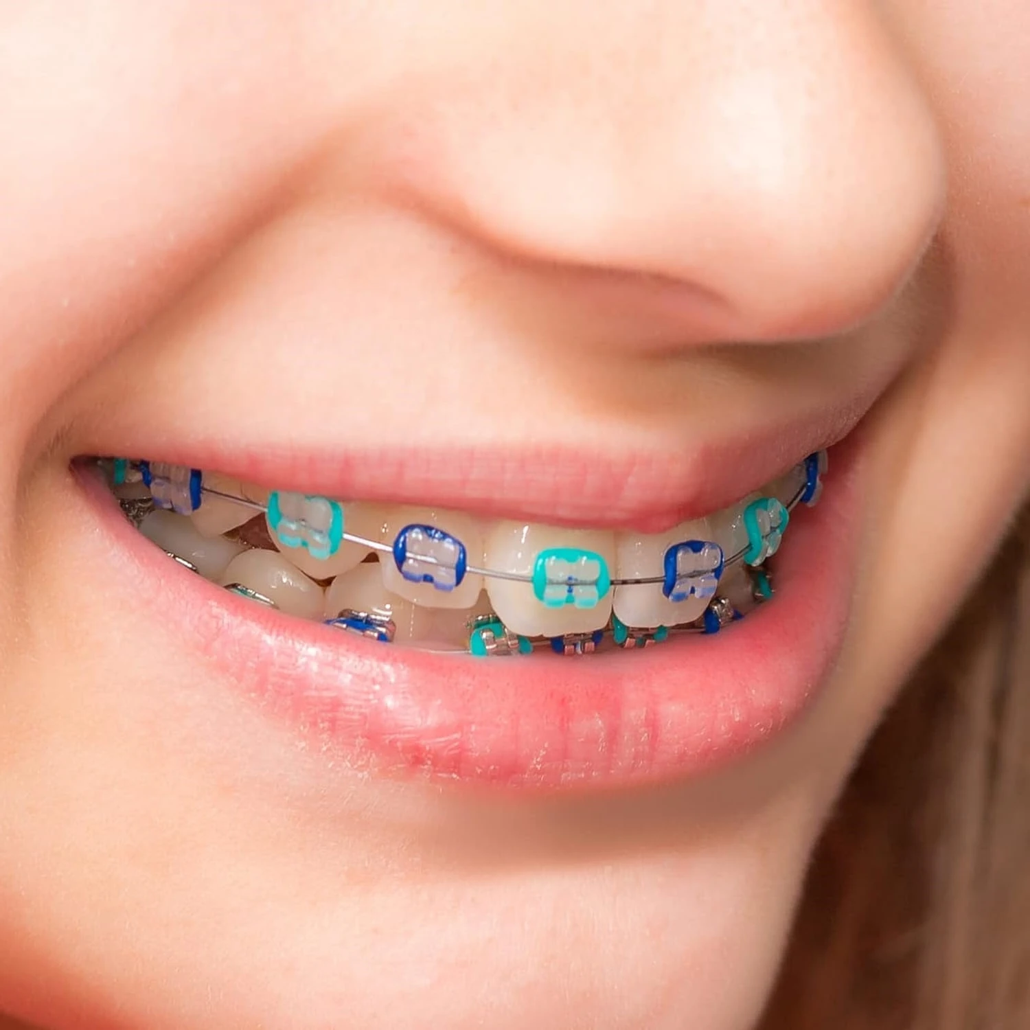 Рисунок 4 - упаковка, Ортодонтические эластичные