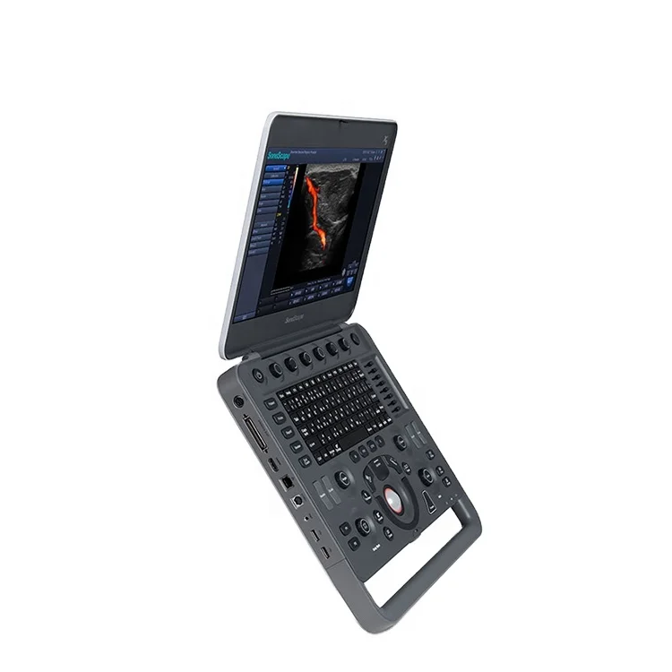 

Yueshen hot selling CE approved Sonoscape X5 portable ultrasound machine with good price