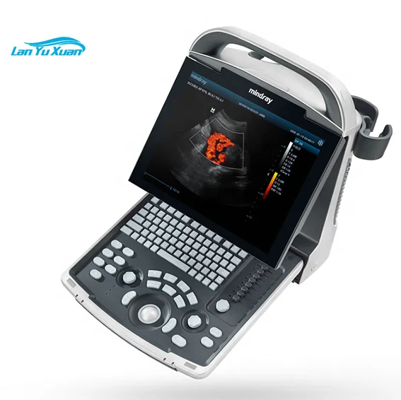 Mindray DP-30 Portable B/W Ultrasound Machine Digital Ultrasound Diagnostic Imaging System