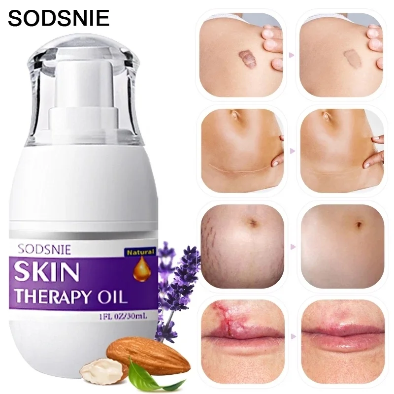 

Scar Remover Essential Oil Stretch Marks Remover Serum Firming Anti-Slackline Natural Skin Therapy Oil Maternity Body Repair