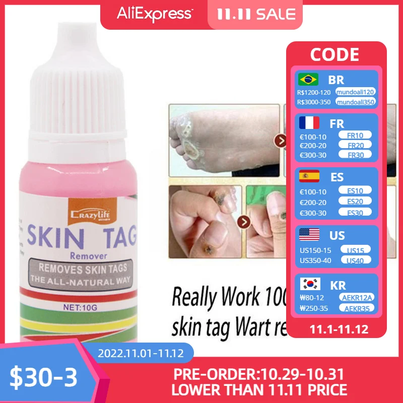 

Chinese Medicine Treatment Foot Corn Removal Cream Warts Warts Medical Treatment Liquid Plaster Foot Ointment Plantar Remov Q5W7