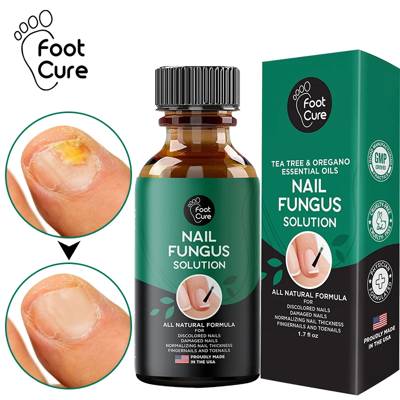 

50ml Fungal Nail Repair Essence Feet CareTreatment Foot Toe Nail Fungus Removal Gel Anti Infection Paronychia Onychomycosis Care