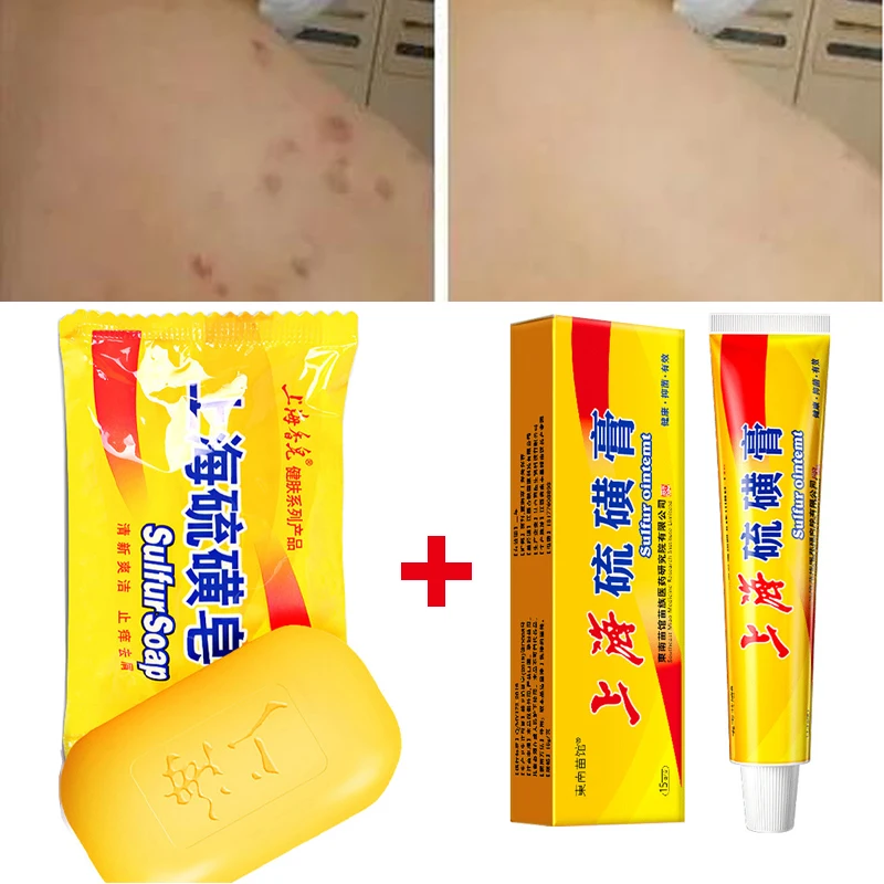 

85g Shanghai Sulfur Soap Oil-Control Acne Treatment Psoriasis Seborrhea Eczema Anti Fungus Bath Soaps and Body Cream Eczema