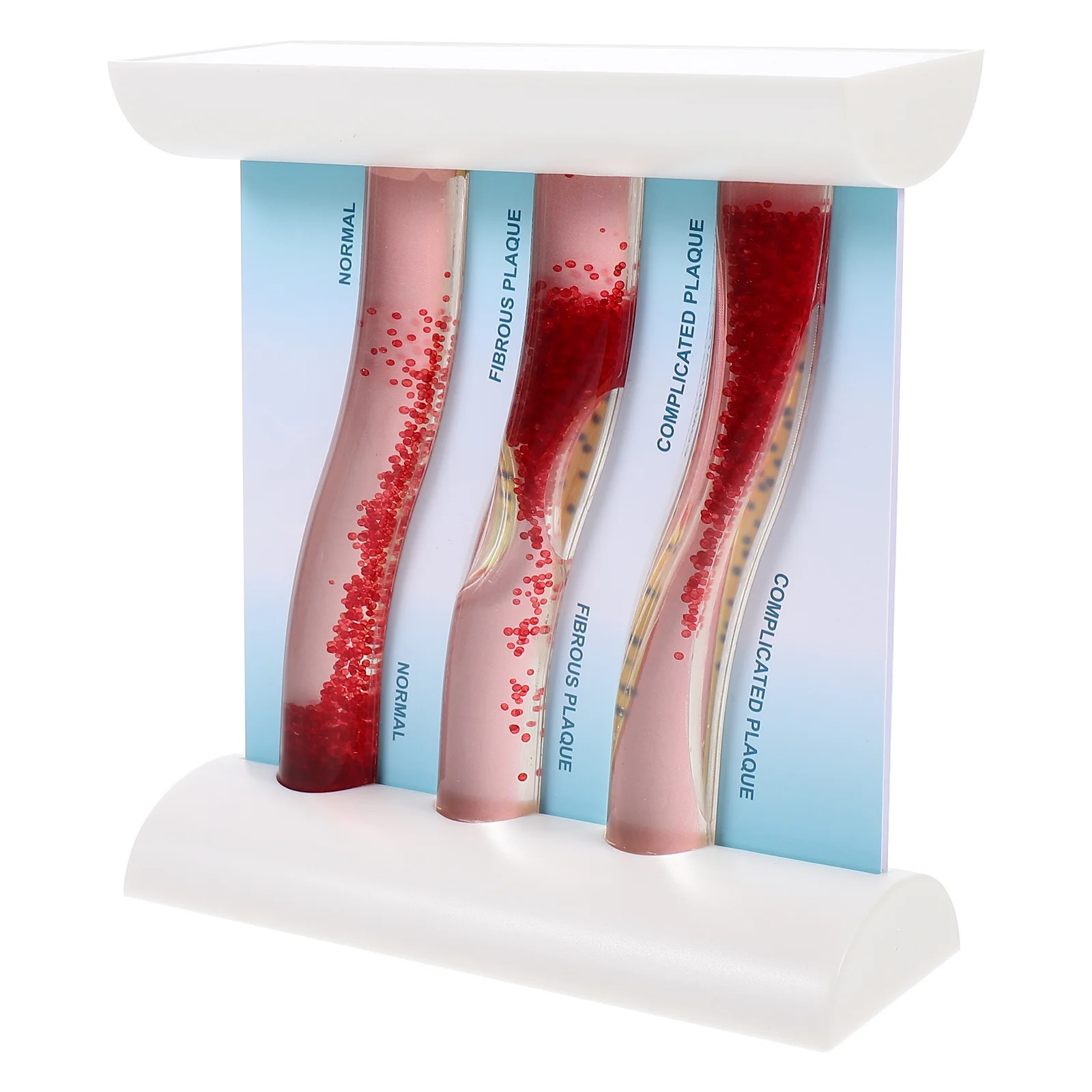 

Dynamic Blood Lipid Vascular Model LDL Anatomical Model Blood Vessel Model