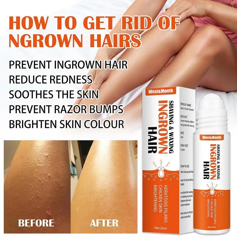 

20g Bump Ingrown Hair Bump Removal Stopper Treatment Serum Reduce Shaving Waxing 2021 Redness Repairing Prevent Skin A5f2