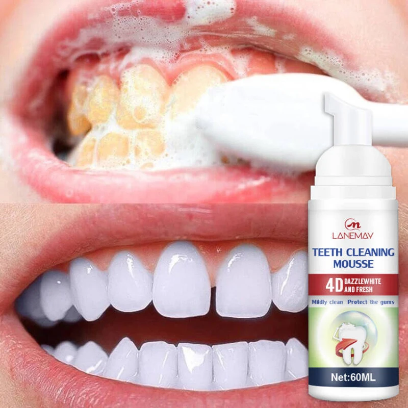 

Teeth Whitening Mousse Remove Plaque Yellow Smoke Stains Pigment Cleaning Hygiene Fresh Breath Strengthen Enamel Oral Care 60ML