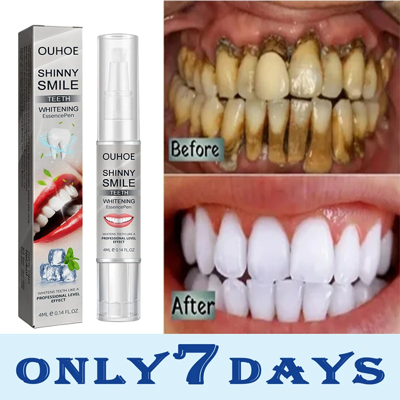 Effective Teeth Whitening Pen Dental Whiten Stains Plaque Tartar Removal Fresh Breath Brighten Teeth Cleaning Gingiva Oral Care