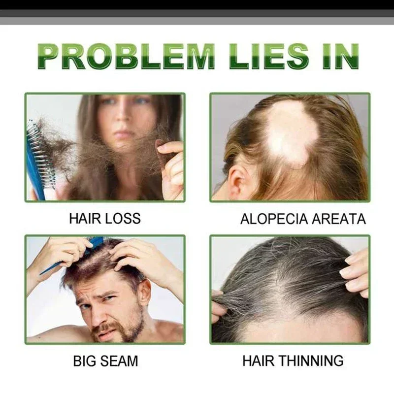 Быстрое искусственное средство для выпадения волос травяное натуральное