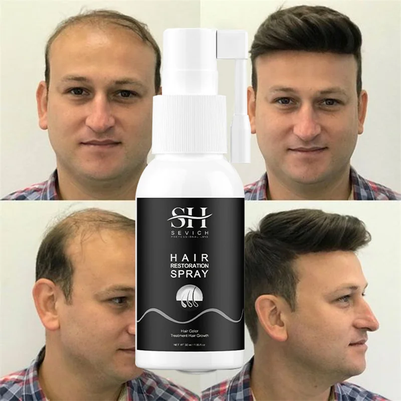 

Herbal White to Black Hair Growth Spray Regenerative Essence Anti Hair Loss Nourishing Repairing Scalp Nutrition Liquid 30ml