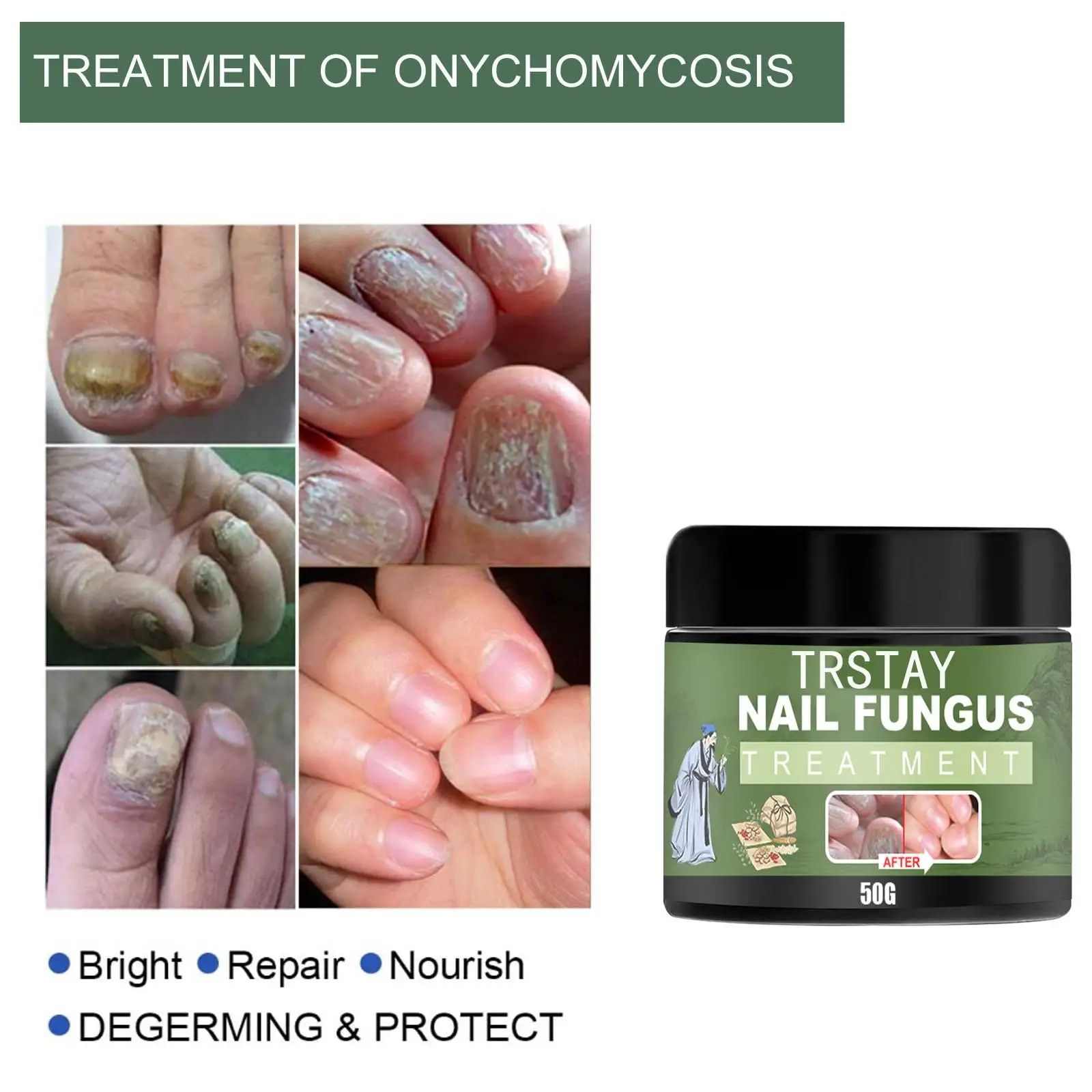 

Nail fungus soft nail cream hand nail manicure soft nail thickening liquid