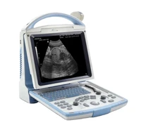 mindray black and white price ultrasound scanner portable ultrasound system dp 10
