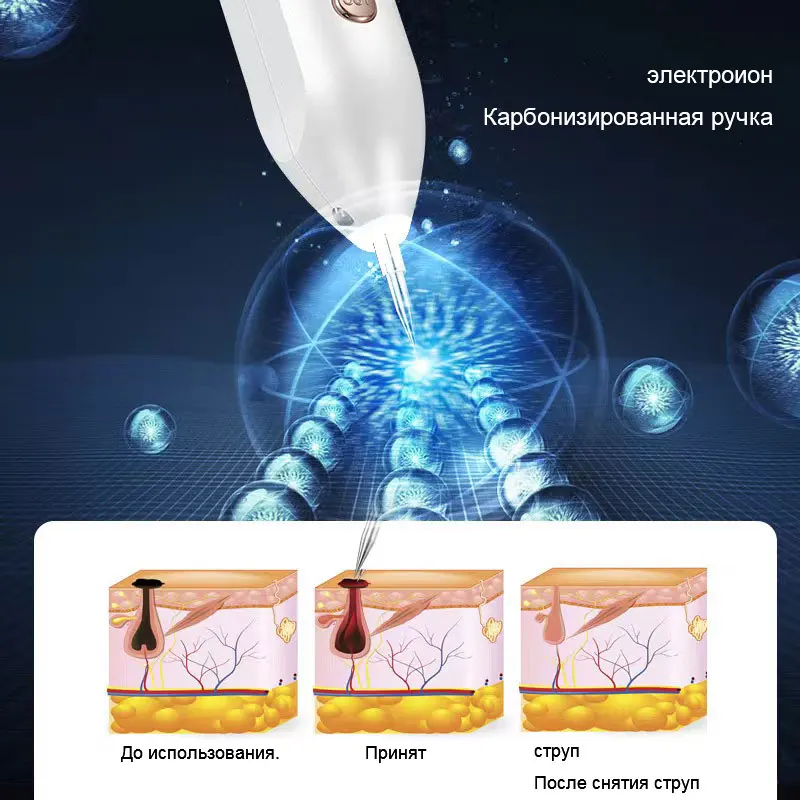 Набор для удаления бородавок с двойной головкой средство плоских подошвенных