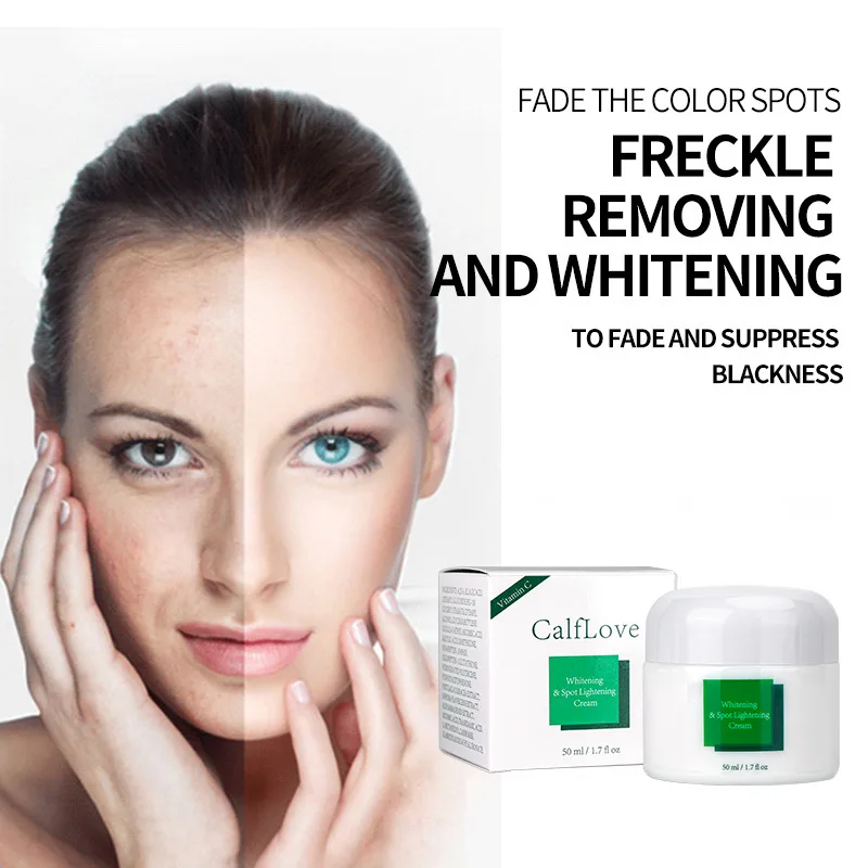 

Powerful Whitening Freckle Cream Remove Acne Spots Melanin Dark Spots Face Brighten Lift Firming Face Skin Care Beauty 50ml