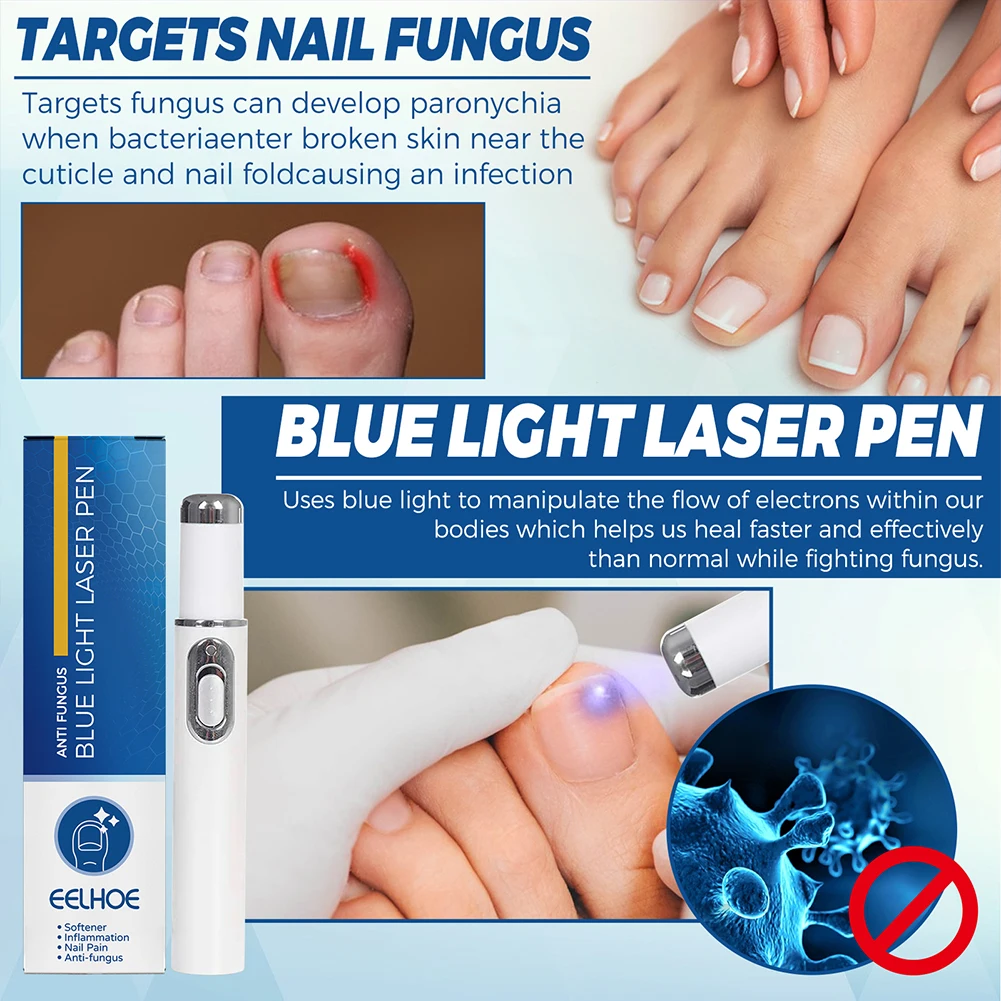 

1/2pcs Nail Repair Pen Blue Light Onychomycosis Treatment Pen Painless Nail Fungus Removal Serum Foot Repair for Men Women