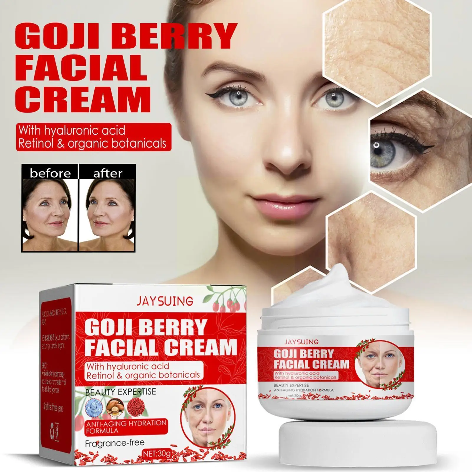 

30g Effective Goji Whitening Cream Freckle Cream Remove Acne Anti-Aging Pigmentation Brighten Melanin Dark Melasma Fade