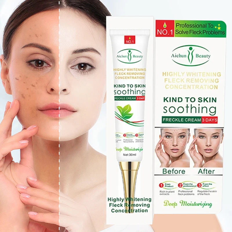 

Freckle Cream Niacinamide Serum Remove Melasma Dark Spots Brighten Fade Pigmentation Repair Anti-Aging Whitening Skin Care 30ml