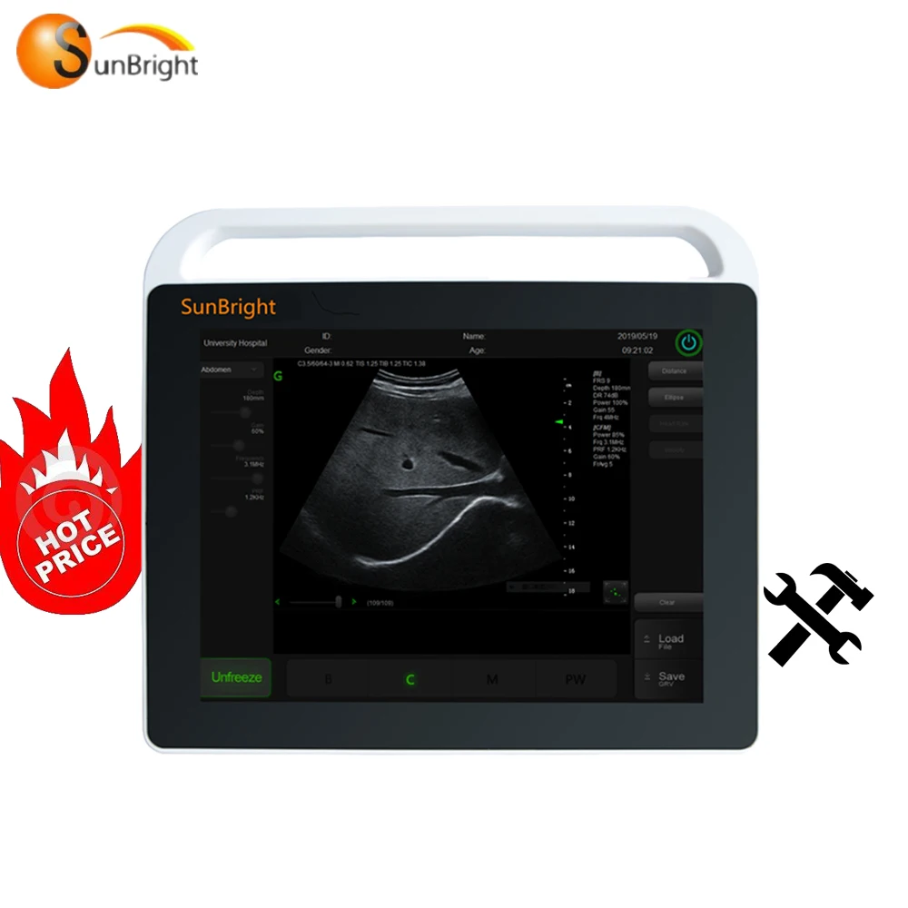 

Ultrasound SUN 800S Machine Excellent Quality CE Black Color Electricity 15.1 Inch LED Online Technical Support 2 Years Class II