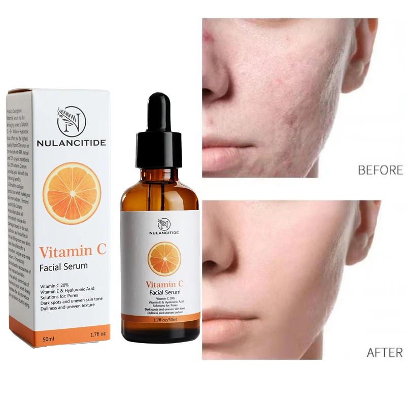 

Retinol Essence With 2.5% Vitamin C Anti-wrinkle Anti-oxidation Whitening Moisturizing Essence Serum Face Care Skin Care