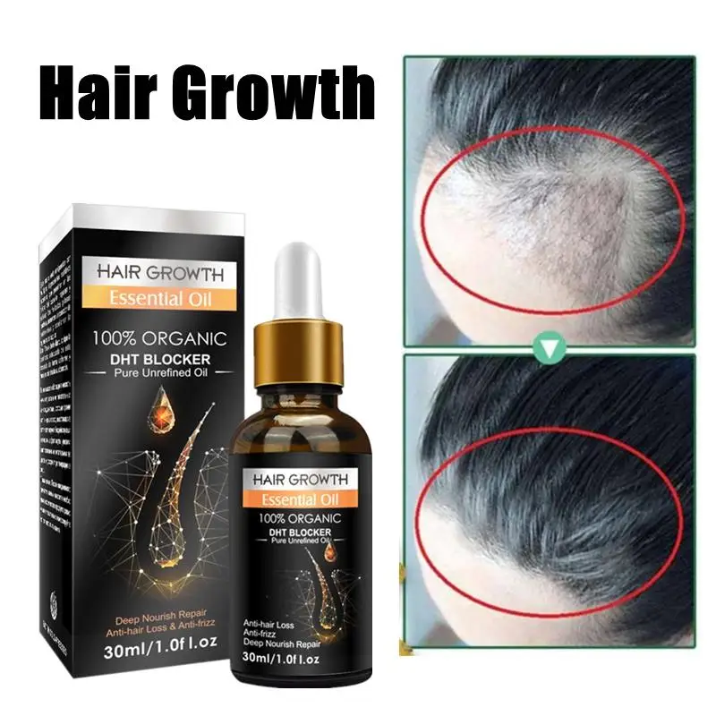 

Hair Growth Essential Oil Anti Preventing Hair Loss Alopecia Liquid Damaged Hair Repair Growing Faster