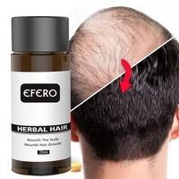fast hair growth oil product prevent hair loss hair regrowth essential oil dense hair restoration growing serum hair care 20ml