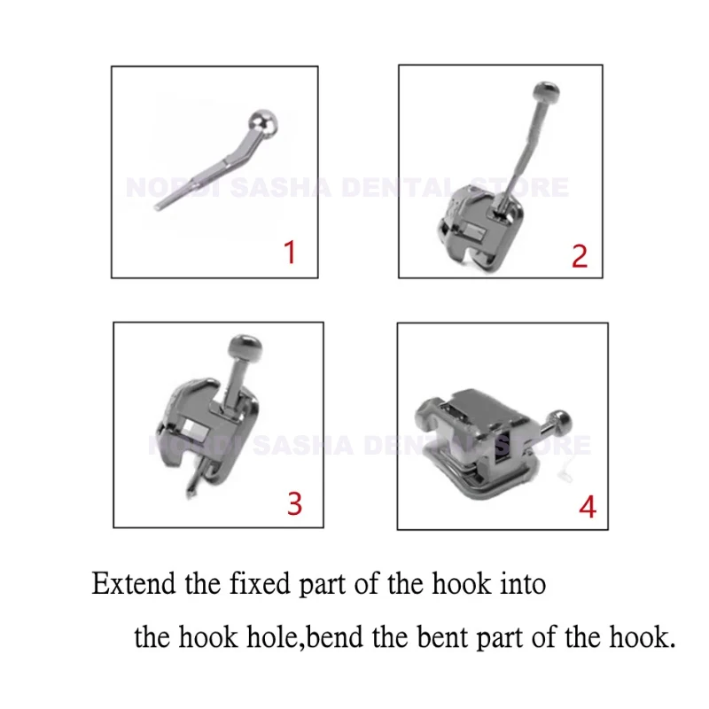 50 шт. = 5 пакетов ортодонтический самолигирующийся крючок
