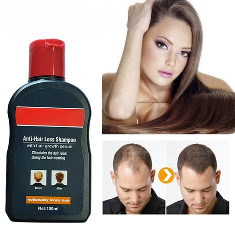 Шампунь против выпадения волос для мужчин и женщин, 100 мл, лечение волос для мужчин, Традиционная китайская медицина, продукт для роста волос