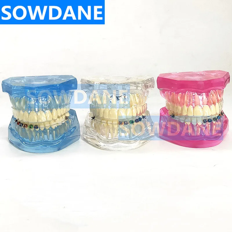 Новая Стоматологическая Ортодонтическая модель зубов для общения с пациентом