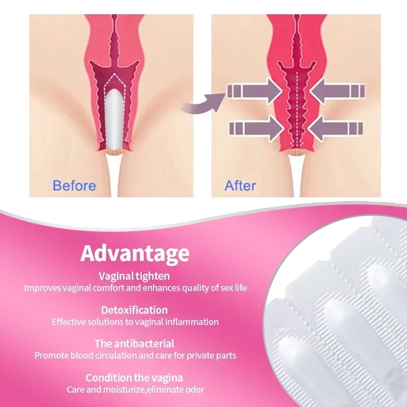 Супозиторий для подтяжки влагалища вагинальная подтяжка лечение расплава